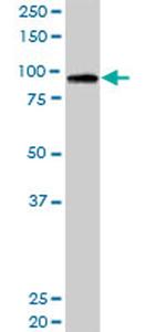 RASA3 Antibody in Western Blot (WB)