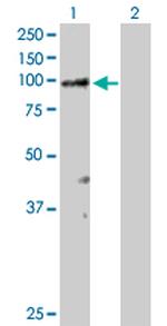 RASA3 Antibody in Western Blot (WB)