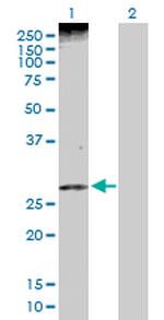 PHLDA1 Antibody in Western Blot (WB)