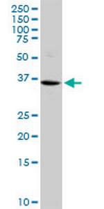 VASH1 Antibody in Western Blot (WB)