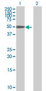 AAK1 Antibody in Western Blot (WB)