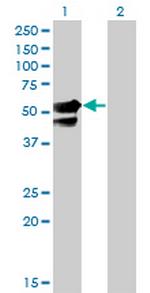 AAK1 Antibody in Western Blot (WB)