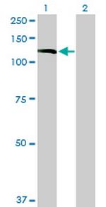 INPP5F Antibody in Western Blot (WB)