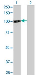 ZHX2 Antibody in Western Blot (WB)