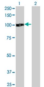 ZHX2 Antibody in Western Blot (WB)