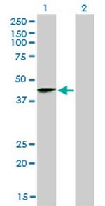 SIRT2 Antibody in Western Blot (WB)