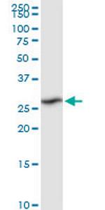 RPIA Antibody in Western Blot (WB)