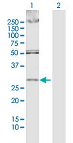 DKK1 Antibody in Western Blot (WB)
