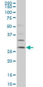 DKK1 Antibody in Western Blot (WB)