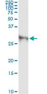 DKK1 Antibody in Immunoprecipitation (IP)