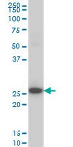 DKK1 Antibody in Western Blot (WB)