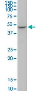 P2RX2 Antibody in Western Blot (WB)