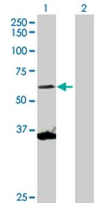 SCMH1 Antibody in Western Blot (WB)