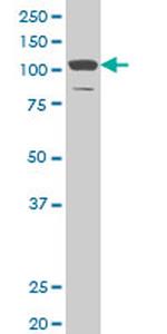 DAAM1 Antibody in Western Blot (WB)