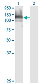 DAAM1 Antibody in Western Blot (WB)