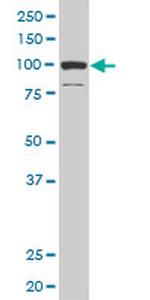 DAAM1 Antibody in Western Blot (WB)