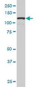 DAAM1 Antibody in Western Blot (WB)