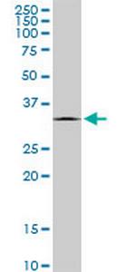 EXOSC7 Antibody in Western Blot (WB)