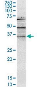 NMNAT2 Antibody in Western Blot (WB)