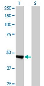 KIAA0261 Antibody in Western Blot (WB)