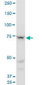 SETX Antibody in Western Blot (WB)