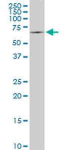 SWAP70 Antibody in Western Blot (WB)