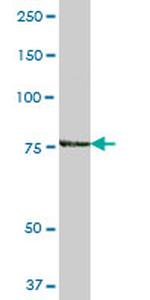 ARHGAP26 Antibody in Western Blot (WB)