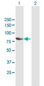 MAP3K7IP2 Antibody in Western Blot (WB)