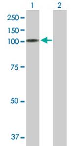 MAST2 Antibody in Western Blot (WB)