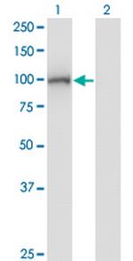 DIP2A Antibody in Western Blot (WB)