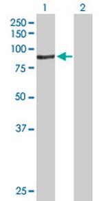 ACSBG1 Antibody in Western Blot (WB)