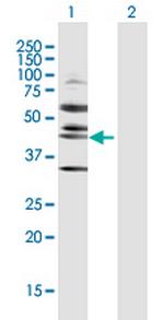 RRS1 Antibody in Western Blot (WB)