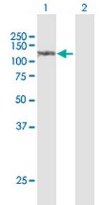 SULF1 Antibody in Western Blot (WB)