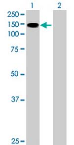 SIK2 Antibody in Western Blot (WB)