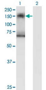 SIK2 Antibody in Western Blot (WB)