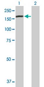 RAB6IP1 Antibody in Western Blot (WB)