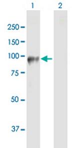 DDHD2 Antibody in Western Blot (WB)