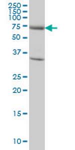 EXOC7 Antibody in Western Blot (WB)