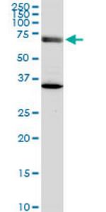 EXOC7 Antibody in Western Blot (WB)