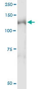 NEDD4L Antibody in Immunoprecipitation (IP)