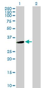 USP24 Antibody in Western Blot (WB)