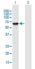 PSD3 Antibody in Western Blot (WB)