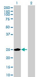 KIAA0892 Antibody in Western Blot (WB)