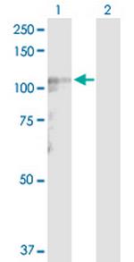 LARS2 Antibody in Western Blot (WB)