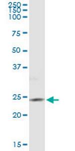 PIP5K1C Antibody in Immunoprecipitation (IP)