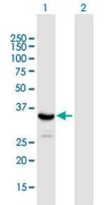 SIRT4 Antibody in Western Blot (WB)