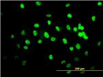 TARDBP Antibody in Immunocytochemistry (ICC/IF)