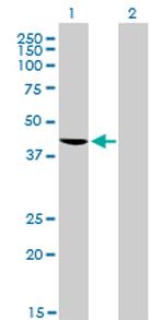 TARDBP Antibody in Western Blot (WB)