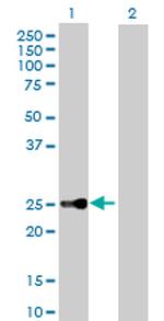 CBX5 Antibody in Western Blot (WB)