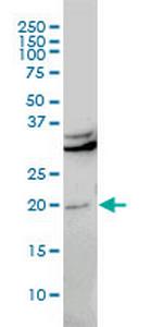 CBX5 Antibody in Western Blot (WB)